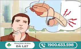 Hình ảnh minh họa